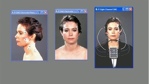 Recording Swallow with EMG