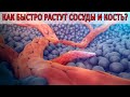 Скорость роста сосудов и образования костной ткани. Результаты набора в резидентуру