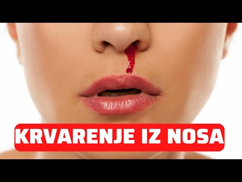 Video: Zakaj mi teče iz nosu?