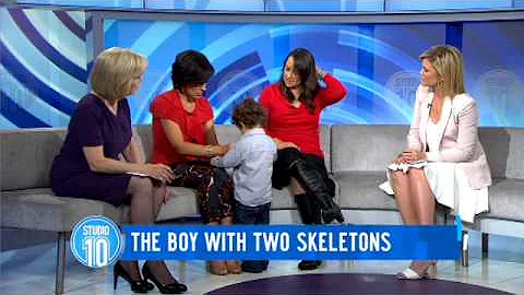 The Boy With Two Skeletons - DayDayNews