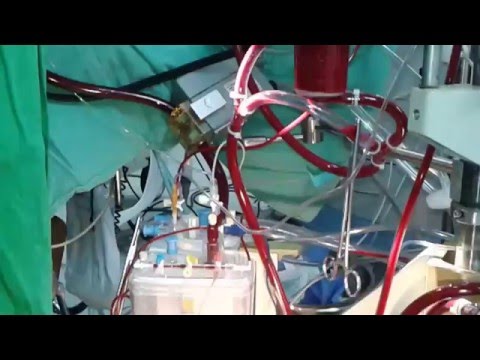 PERFUSION TECHNOLOGY IN SHORT VIDEO EXPLAINED , !!