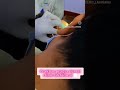 upper 6 RCT going on #dentist #viralvideo #trendingnow