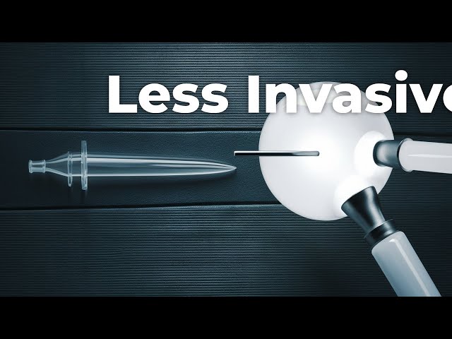 laparoscopic Surgery in Gastrointestinal Cancers: A Minimally Invasive Approach- Best general and laparosopic surgeon in india