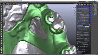 B4D Splint Module