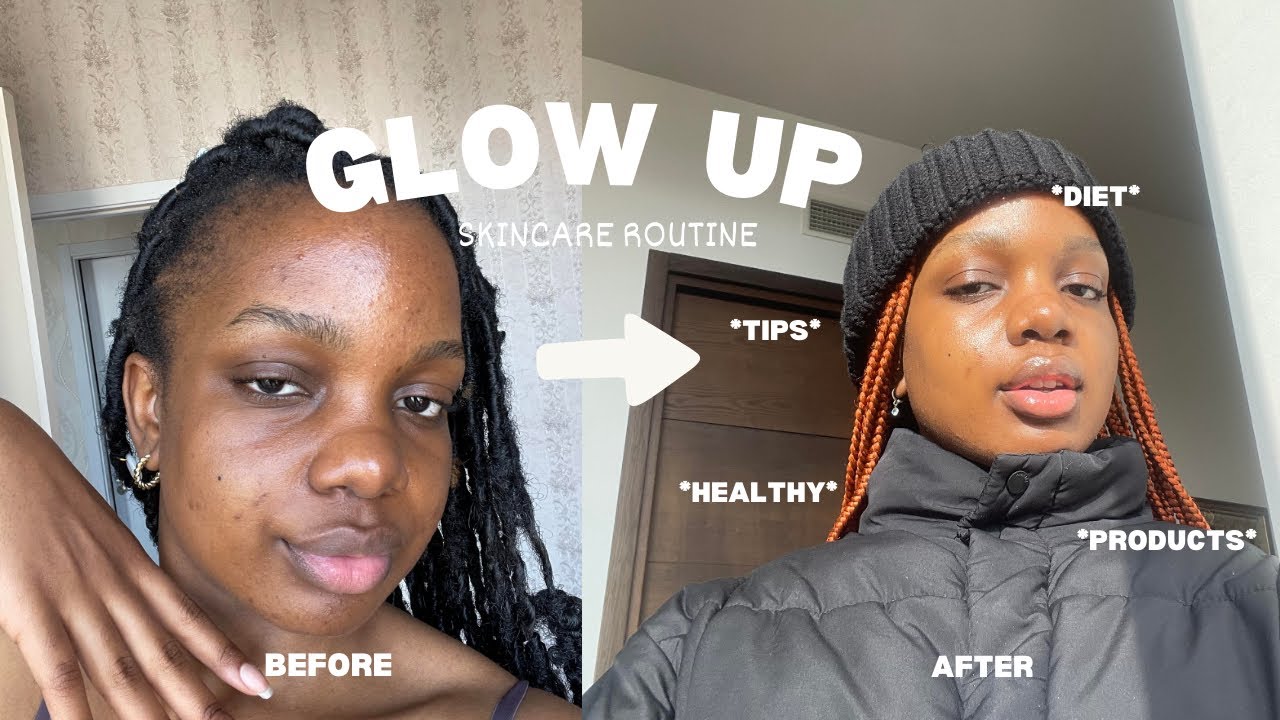 HOW I *realistically*CHANGED MY SKIN IN 2 MONTHS | weekend vlog - YouTube