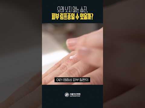 오래 낫지 않는 <strong>습진</strong>, 피부 림프종일 수 있을까?