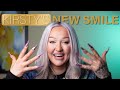 Same Day Smile: Kirsty's Story