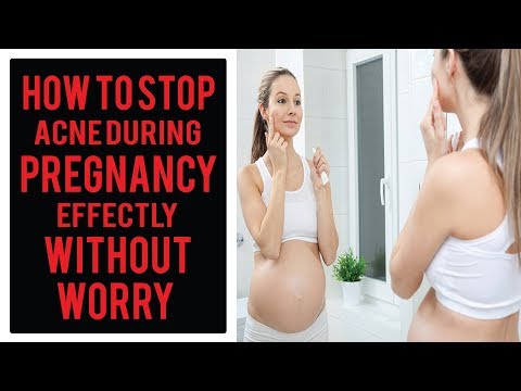 Acne Causes | Pregnancy Acne | How To Get Rid Of Acne During Pregnancy | Pregnancy Acne Home Remedy