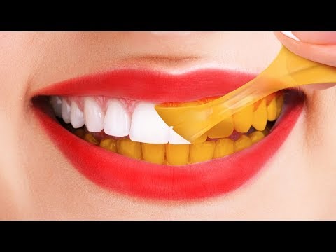 Видео: Получите ослепительную улыбку, которую вы заслуживаете, с этими лучшими отбеливателями для зубов