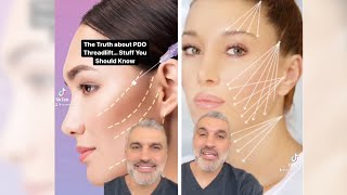 The TRUTH About PDO Threadlift - are they worth it? screenshot 1