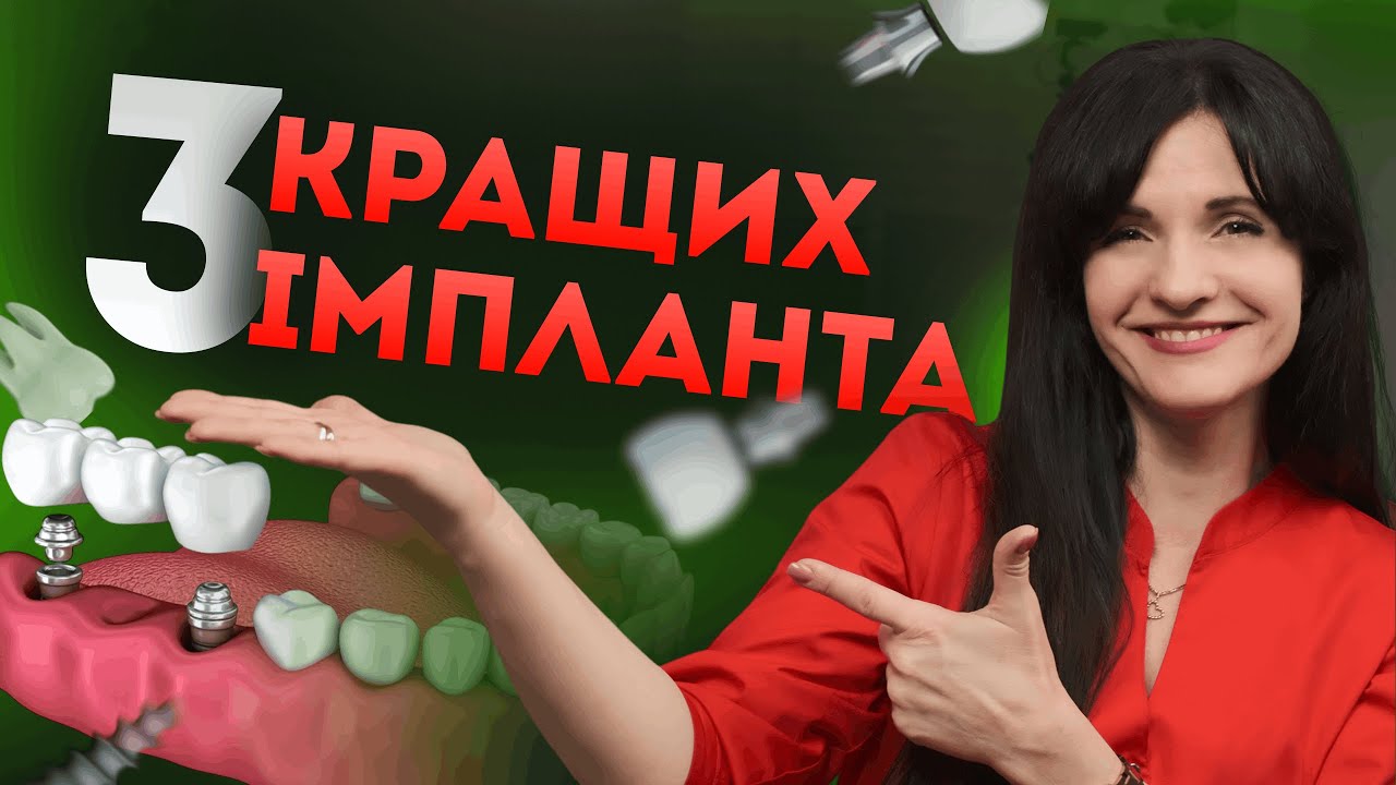 Як обрати зубні ІМПЛАНТИ у 2026? 3 КРАЩИХ імплантати!