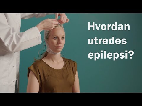 Video: Epilepsi Hos Katte: Symptomer På Sygdommen, Hvordan Man Stopper Anfald, Kan Anfald Forhindres, Behandlingsmetoder, Veterinæranbefalinger