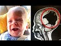 Baby Was Born With 'No Brain' 3-Years-Later, Doctor Scans And Discovers A Miracle