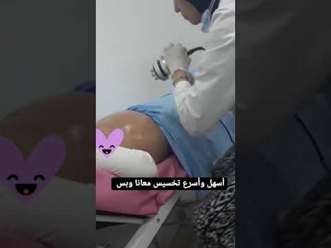 جلسات الكافيتيشن والكرايو للتخسيس معانا هتخسي في غمضه عين ومن غير ماتحسي Dr Radwa Elkhamisy  جلسات الكافيتيشن والكرايو للتخسيس معانا هتخسي في غمضه عين ومن غير ماتحسي Dr Radwa Elkhamisy