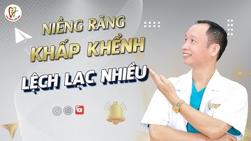 Niềng răng mắc cài cho trường hợp răng khấp khểnh lệch lạc