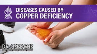 Diseases Caused by Copper Deficiency