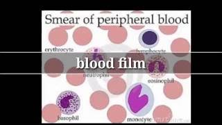 Blood film تحليل ..