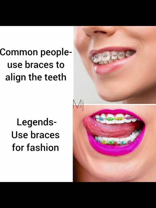 Ortho memes | World Orthodontic Day | 15 May | #orthodontics