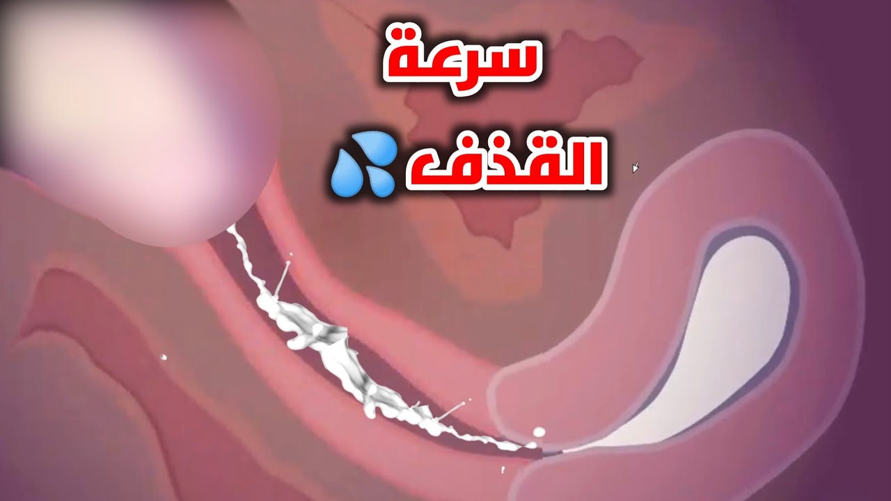 سرعه القذف عند الرجال واحدث الطرق لعلاجها _ premature ejaculation