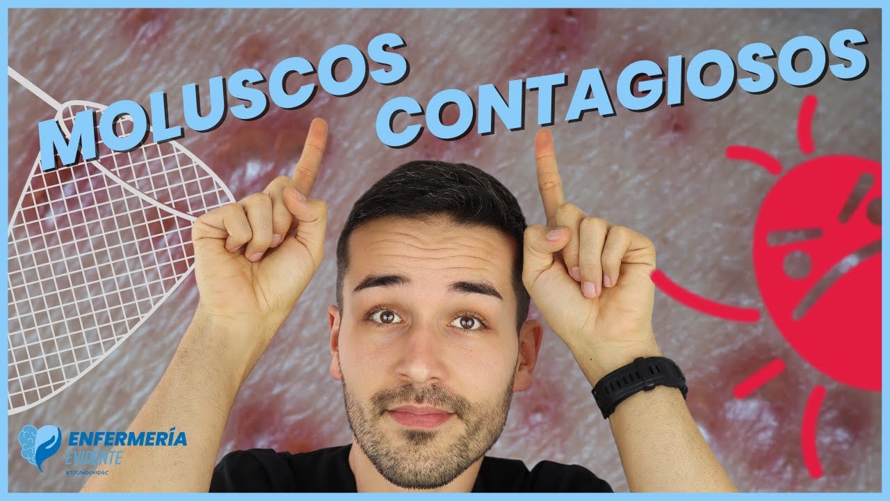 ❌ESTO es LO que HAGO para ELIMINARLOS💯