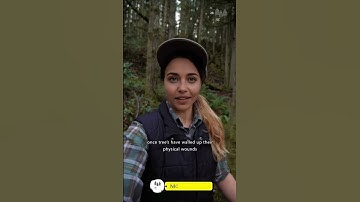 "The Secret Healing Power of Trees – Just Like Humans! 🤯"