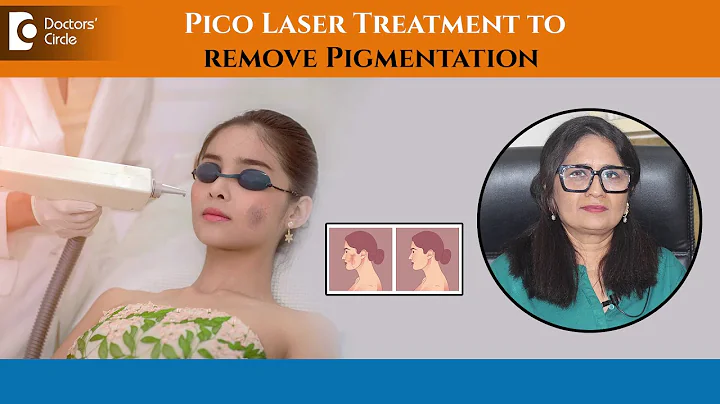 How to get Rid of Pigmentation on Face with Pico Laser Treatment?-Dr. Aruna Prasad | Doctors' Circle