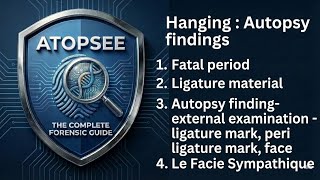 Hanging: Autopsy finding, external examination,le facie sympathique