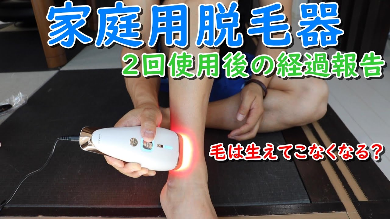 家庭用脱毛器の効果は男のすね毛でも生えなくなるのか？の検証に2回使用後の経過報告！