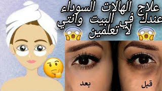 التخلص من الهالات السوداء في اسبوع بمكون واحد موجود في بيتك (الفيديو الاول١)