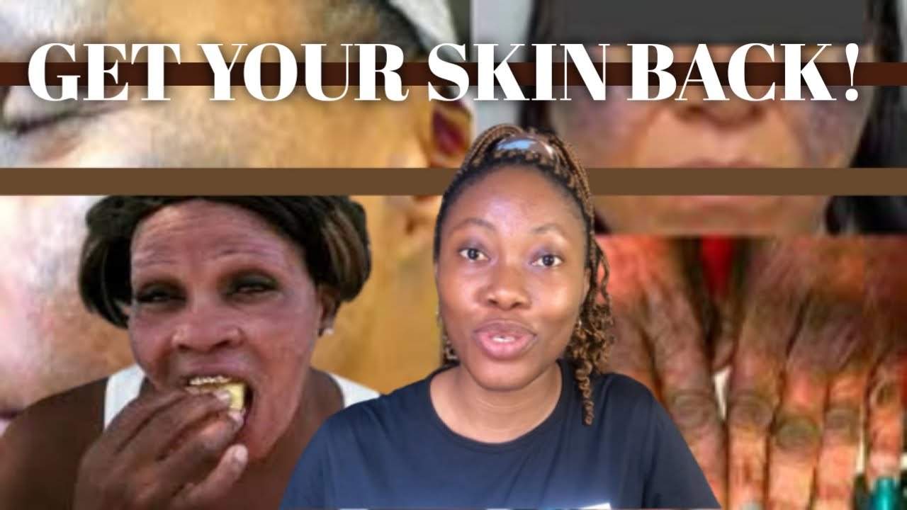 How to repair damaged bleached skin. YouTube