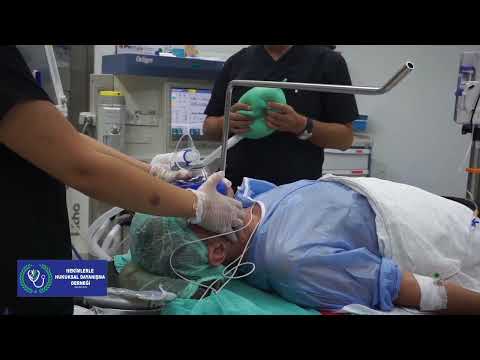 Video: Genel Anestezi Uygulamanın 4 Yolu