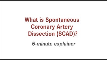 SCAD explained in 6 minutes