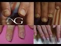 Вопрос/ответ: покрытие гель лаком, проблемные ногти / Manicure of problem nails