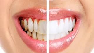 أسباب تسوس الأسنان و كيفية التخلص من تسوس الأسنان