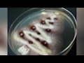 Биология как искусство: микробиологи БГУ рисуют картины из бактерий!