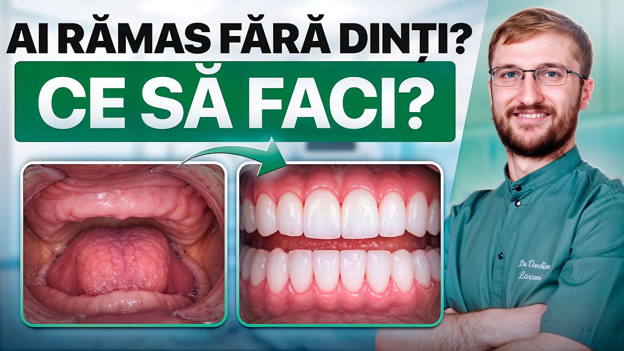 Ce să faci dacă ai rămas fără niciun dinte în gură? E posibil să pui implanturi pentru toți dinții?
