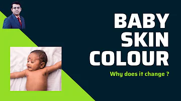 Do babies skin get lighter or darker?