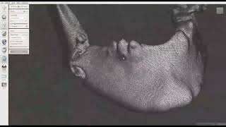 Mandible segmentation and cleaning - Timelapse