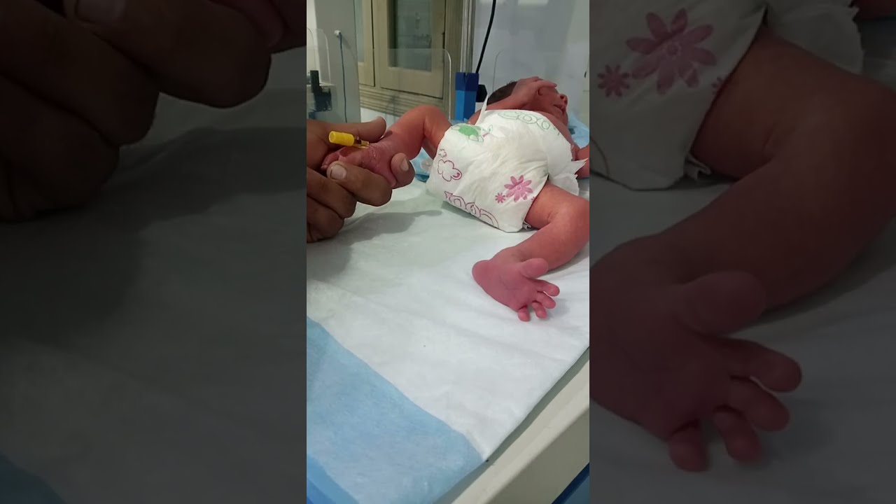 How to Pass IV Line for Antibiotics | Step-by-Step IV Cannulation Tutorial