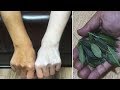 Skin Whitening Home Remedies Neem Leaves and Turmeric, Haldi Facial