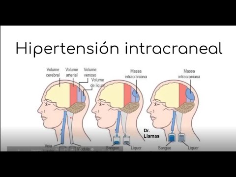 Video: Inflamación Del Cerebro Y Del Tejido Cerebral En Conejos