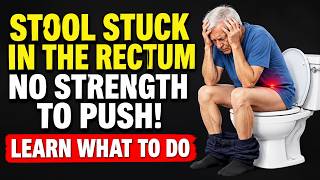 Stool STUCK in the Rectum What Is It and What Should You Do – Doctor Reveals!