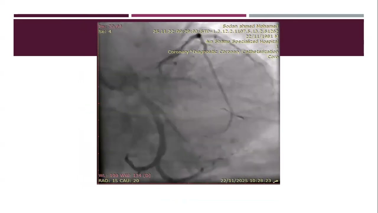 postcath conference 10 december 2025