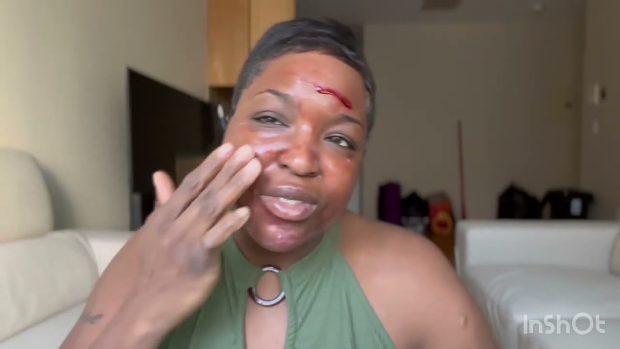 The Ordinary AHA 30% +BHA 2% Peeling Solution Review 