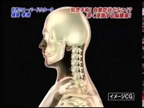 【脳外科医　福島孝徳】「覚悟を決めた方がいい」骨をも溶かす脳腫瘍。リスク覚悟の緊急手術に福島が立ち上がる。
