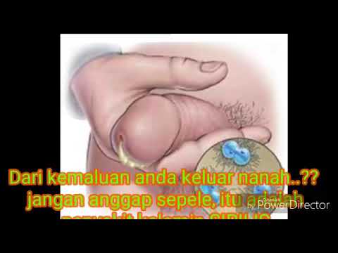 obat-sipilis-paling-aman-dan-ampuh