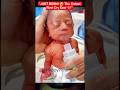 Just Born Baby’s First Cry Melted Our Hearts 🥹👶 #newbornbaby #cutebaby #shorts #babylove