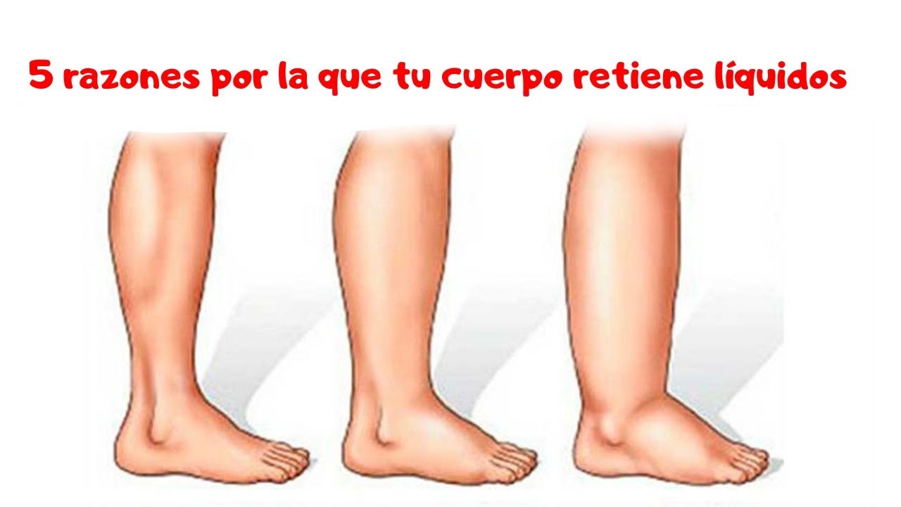 5 razones por la cual tu cuerpo retiene líquidos