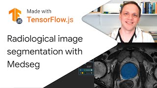 Radiological image segmentation with Medseg - Made with TensorFlow.js screenshot 2