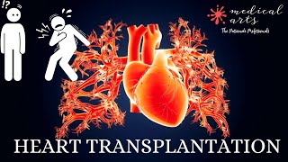 Cardiac Transplantation - Heart Transplantation Questions Answered, Informative Educational Video